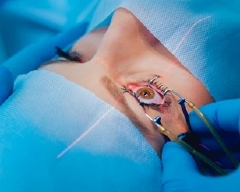 Cirurgias de Glaucoma Avançado Itaquaquecetuba - Cirurgia de Glaucoma com Implante de Válvula