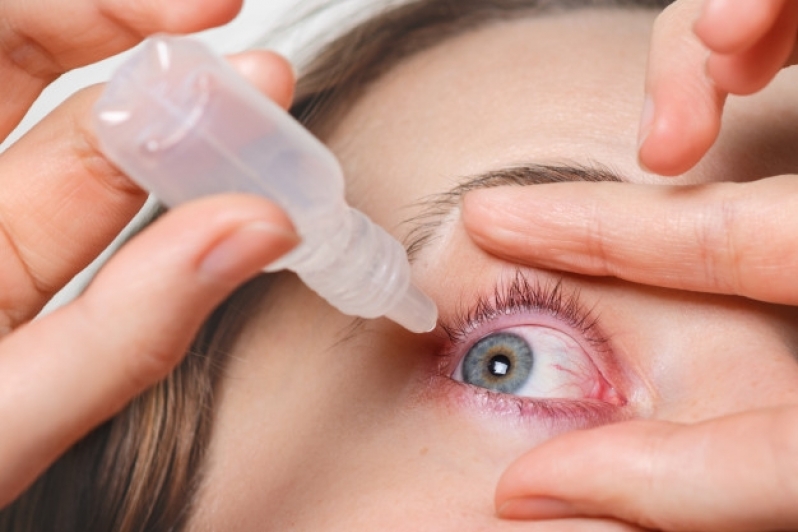Clínica para Olho Seco Tratamento Tucuruvi - Tratamento a Laser para Olho Seco