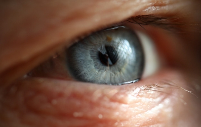 Onde Fazer Cirurgia de Catarata em Idosos Carapicuíba - Cirurgia de Catarata no Olho