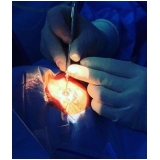 cirurgia retirada bolsa olhos clínica Mogi Mirim
