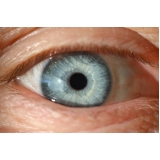 Cirurgia a Laser do Olho