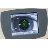preço de exame de fundo de olho e mapeamento de retina Casa Verde